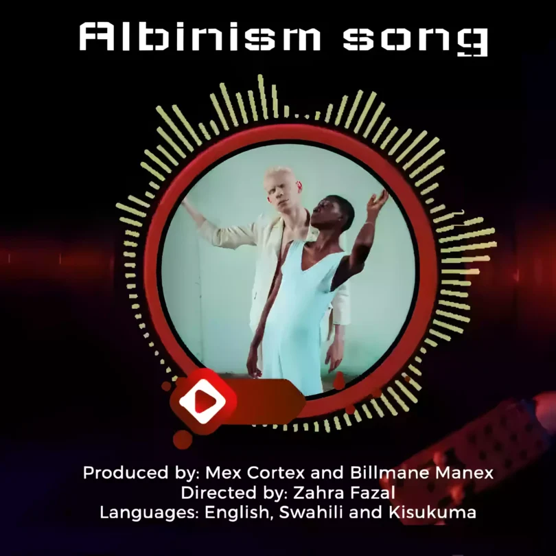 Albinism Song By Mex Cortez